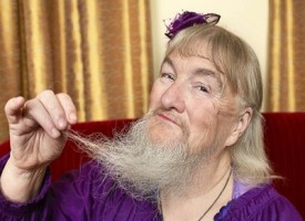 Dopo trent’anni trova la madre biologica e scopre che è la donna più barbuta del mondo
