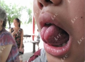 Xiao Xin, il ragazzo cinese che afferra gli oggetti con la lingua