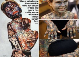 Julia Gnuse, costretta da una rara malattia a tatuarsi tutto il corpo