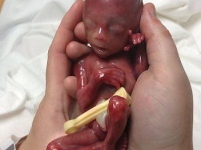 bimbo prematuro