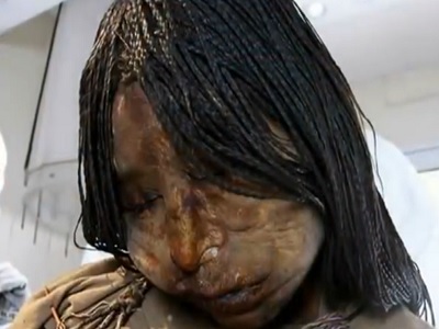 bambina congelata dopo 500 anni